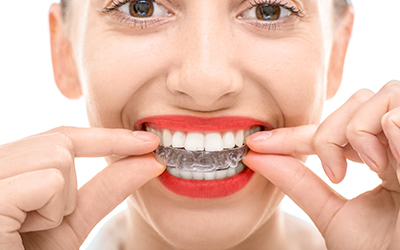 Woman putting a clear retainer on her teeth