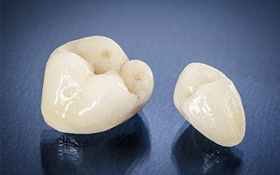 dental crowns